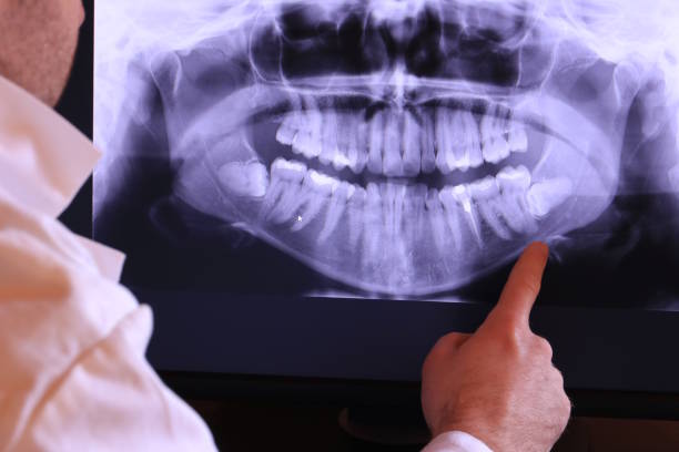 Best Broken or Chipped Tooth Repair in North Bethesda, MD